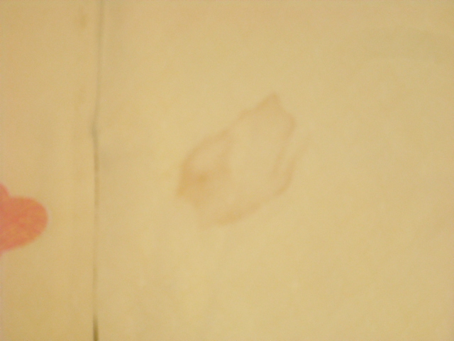 脇の汗しみが黄変