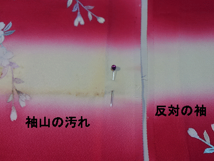 袖山の黄変した汚れ